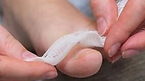 MD: If You Have Toenail Fungus, Do This Immediately (Watch)